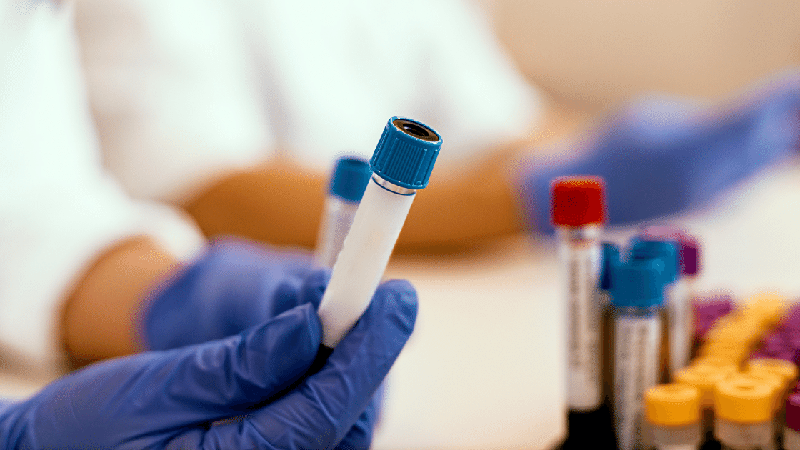 Saliva Testing for Bioidentical Hormone Replacement Therapy